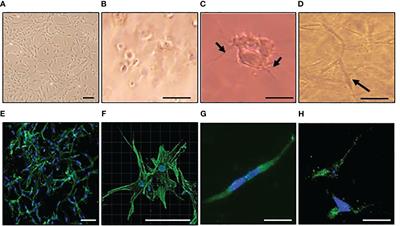 Investigating mechanical and inflammatory pathological mechanisms in osteoarthritis using MSC-derived osteocyte-like cells in 3D